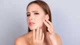 Dartres sur le visage: causes et traitements naturel