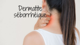 Dermatite séborrhéique: les meilleurs traitement naturel